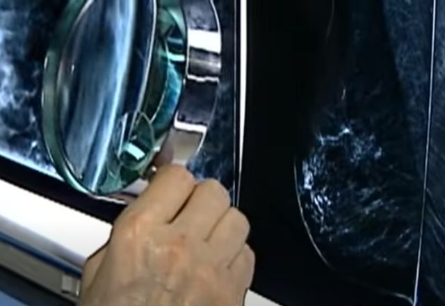 25% das mortes nos últimos anos poderiam ter sido evitadas pela melhoria do acesso a cirurgia | SBT