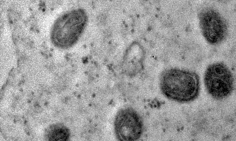 Mpox é considerada emergência sanitária global desde o último dia 14 de agosto | Fabio Pozzebom/Agência Brasil