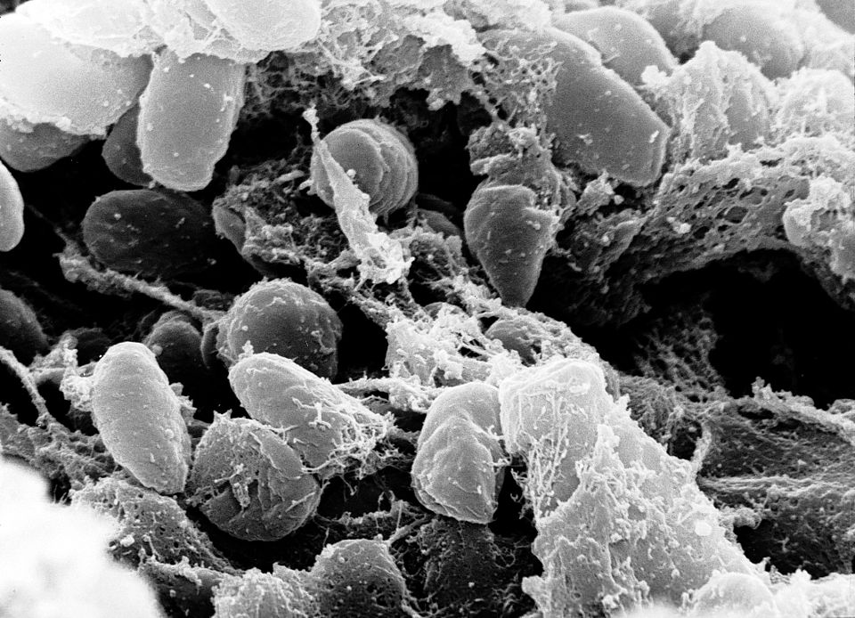 Peste negra é causada pela bactéria Yersinia pestis | Reprodução/Wikimedia Commons
