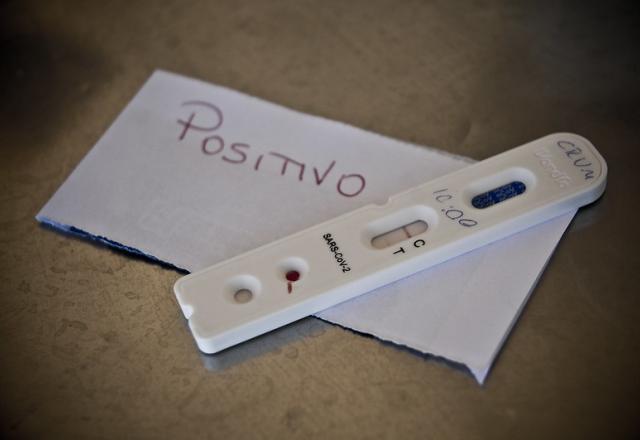 Teste com resultado positivo para covid-19, sobre objetivo em que está escrita a palavra 'positivo' (Breno Esaki/Agência Saúde)
