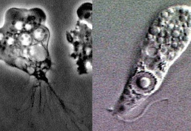 Ameba Naegleria fowleri pode ter causado morte de menina de 1 ano no interior do Ceará | Wiki