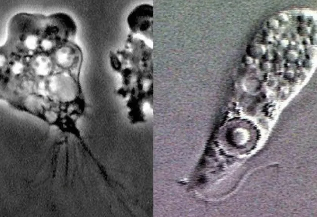 Ameba Naegleria fowleri causou morte de menina de 1 ano no interior do Ceará | Wiki