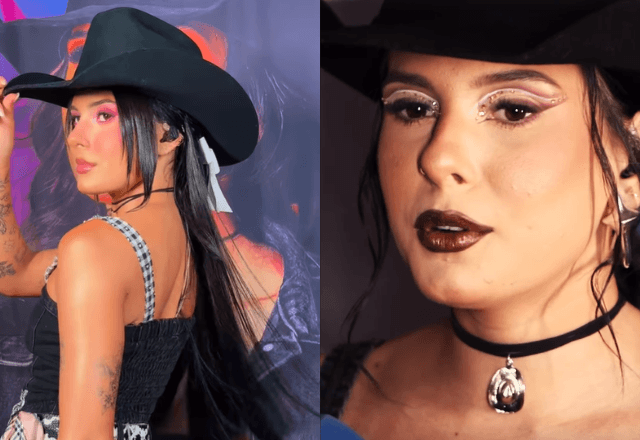 Ana Castela revela tratamento contra acne | Reprodução