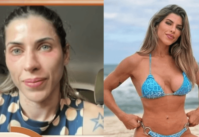 Ana Paula Mineratto já gastou mais de R$ 50 mil com a aplicação do produto | Reprodução/Instagram