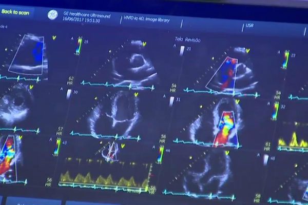 Anvisa aprova venda de medicamento para insuficiência cardíaca