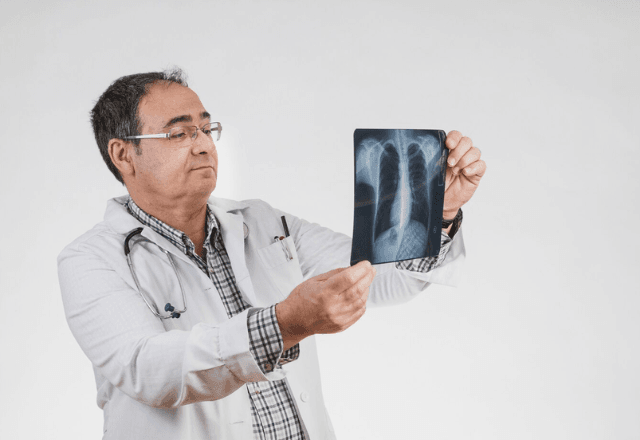 Câncer de pulmão: inovações do tratamento podem mudar futuro dos pacientes | Freepik