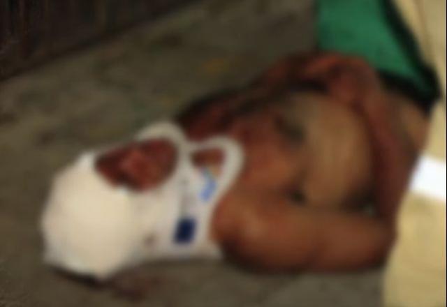 Catador de lixo é agredido com machadadas na cabeça