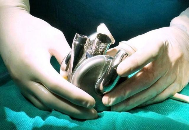 Cientistas implantam 1º coração totalmente artificial feito de titânio em paciente humano | Divulgação/BiVACOR, Inc.