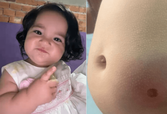 Esther Vitória, de 11 meses, que sobreviveu após ser atingida por uma bala perdida na barriga em Cidade Tiradentes, zona leste de São Paulo | Fotos: Arquivo pessoal