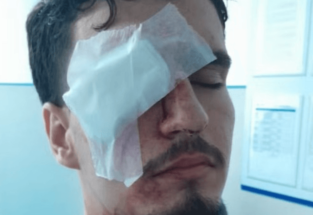 Protocolos para disparos com balas de borracha entram em discussão após caso no Rio Protocolos para disparos com balas de borracha entram em discussão após caso no Rio