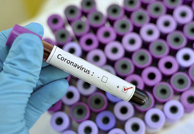 Coronavírus: Adolescente sem sintomas da doença é o 4° caso confirmado no Brasil Coronavírus: Adolescente sem sintomas da doença é o 4° caso confirmado no Brasil