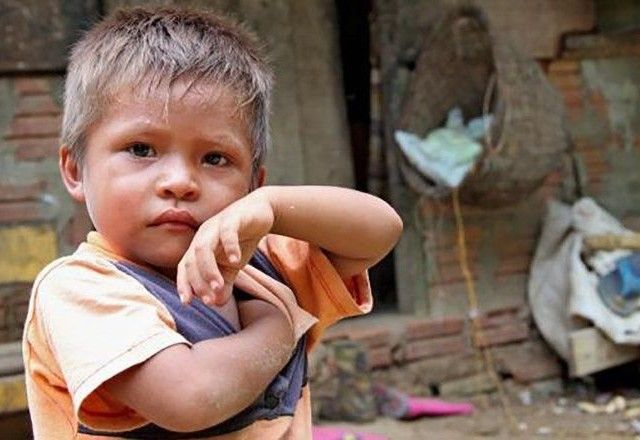 Criança na região amazônica brasileira | Divulgação/Unicef/Giacomo Pirozzi