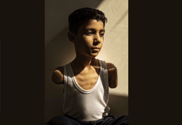 Criança palestina que perdeu os braços em ataque a Gaza é eleita foto do ano pela World Press Photo