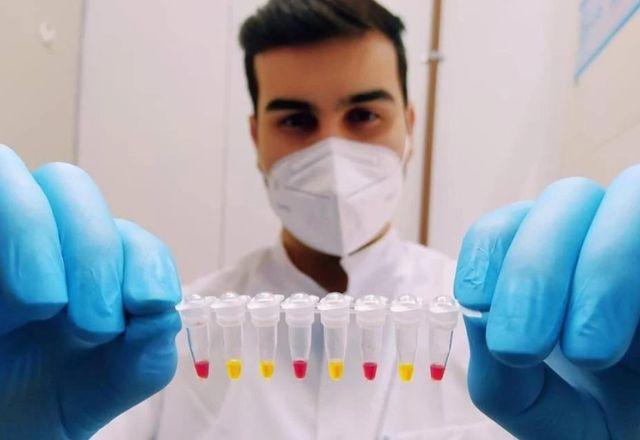 Custo médio de produção por unidade do exame ficaria em torno de R$ 3 | Divulgação