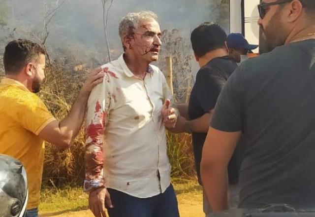 Deputado federal é atendido pelo SAMU minutos após o acidente, não houve mortos | Divulgação
