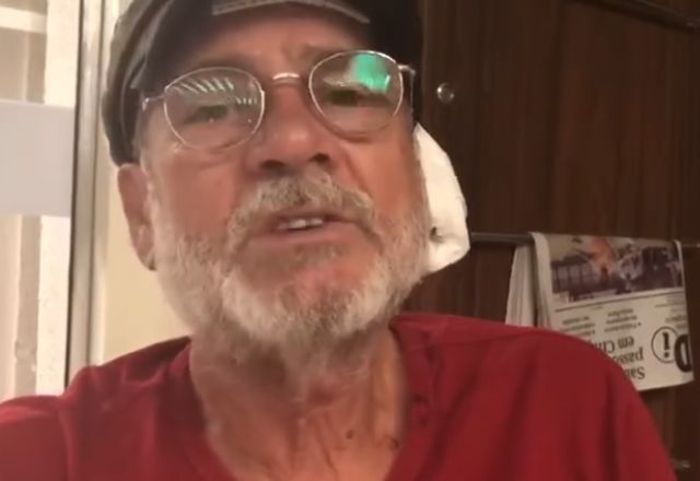 Paulo Frateschi foi atingido por pedrada durante caravana de Lula em 2018 | Reprodução