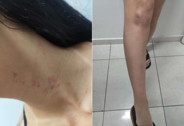 Bia Miranda relatou, por meio das redes sociais, que havia sido agredida | Reprodução