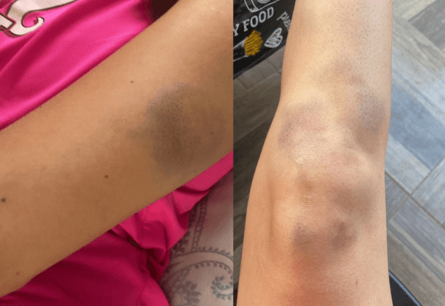 Agressões caso Thiago - Reprodução