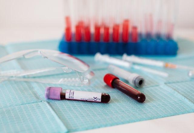 Doença consiste em inflamação do fígado e inclui elevada taxa de enzimas hepáticas, fraqueza e dores abdominais | Pexels