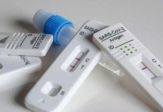 Em relação aos óbitos, a presença dos vírus entre os casos positivos foi de 79,5% para Sars-CoV-2 | Divulgação