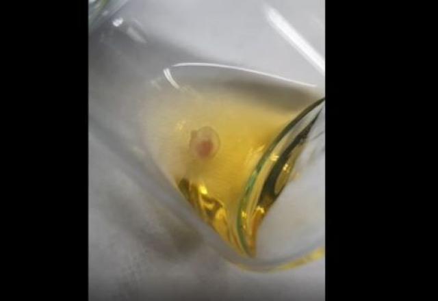 Embrião de camundongo em útero artificial