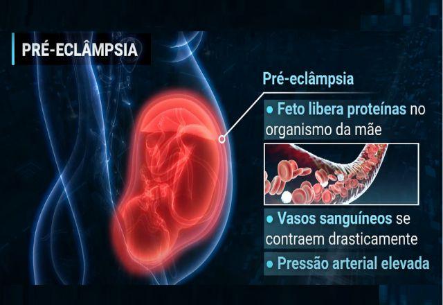 Entenda o que é pré-eclâmpsia