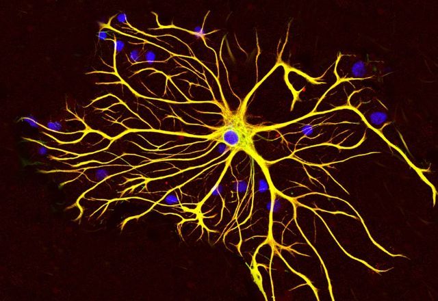 Proteger o cérebro do Alzheimer? Estudo brasileiro traz nova aposta contra a doença; entenda Proteger o cérebro do Alzheimer? Estudo brasileiro traz nova aposta contra a doença; entenda
