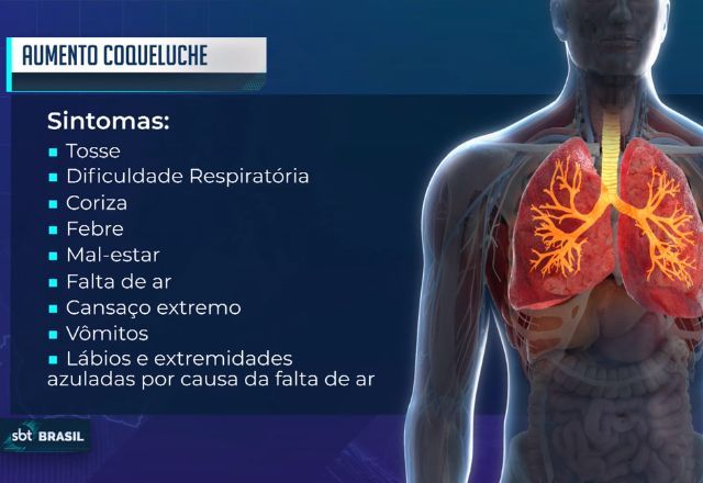 Fique atento aos sintomas da coqueluche, teve aumento de casos no Brasil | SBT