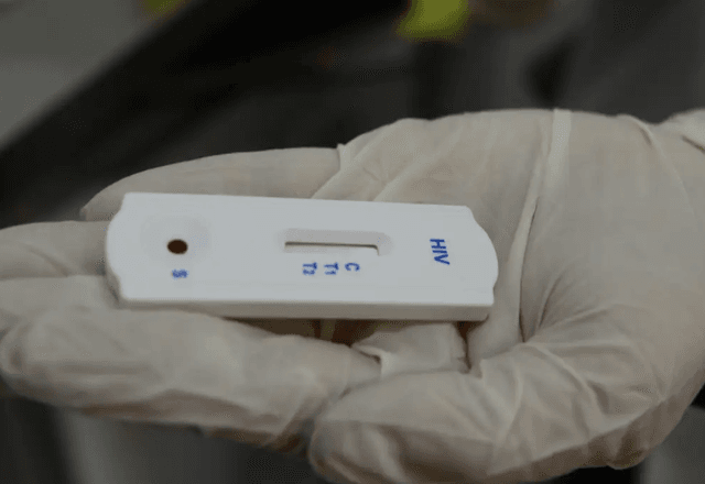 Foram registrados 43.403 novos casos de HIV no país, com uma predominância de 73,6% entre homens |  Rovena Rosa/Agência Brasil 
