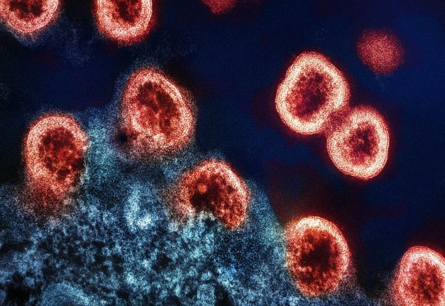 Brasil Agora: Veja o que se sabe sobre os transplantes de órgãos com HIV