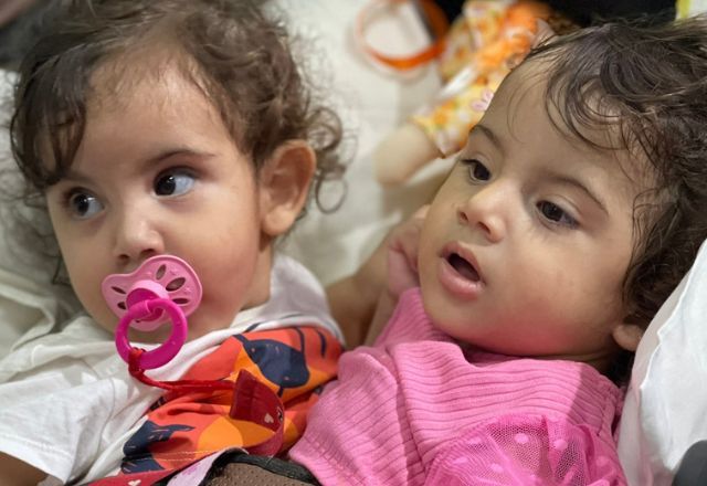 Após 19 horas, hospital conclui cirurgia de separação de gêmeas siamesas