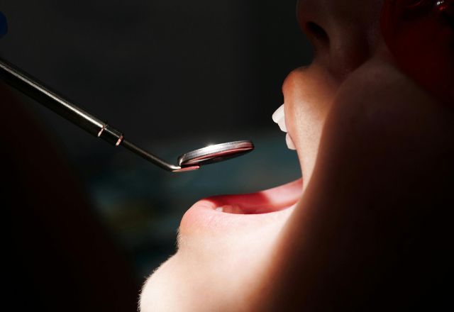 Saúde bucal: o que os dentes revelam sobre o corpo? | Pexels