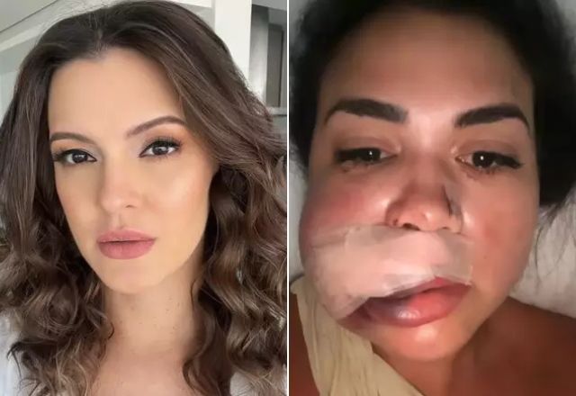Modelo Fernanda Bonito e a consultora imobiliária Milka Borges se envolveram em briga no restaurante do Jockey Clube de São Paulo | Reprodução