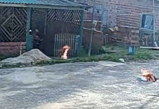 Homem é preso por tentativa de feminicídio após atear fogo na companheira