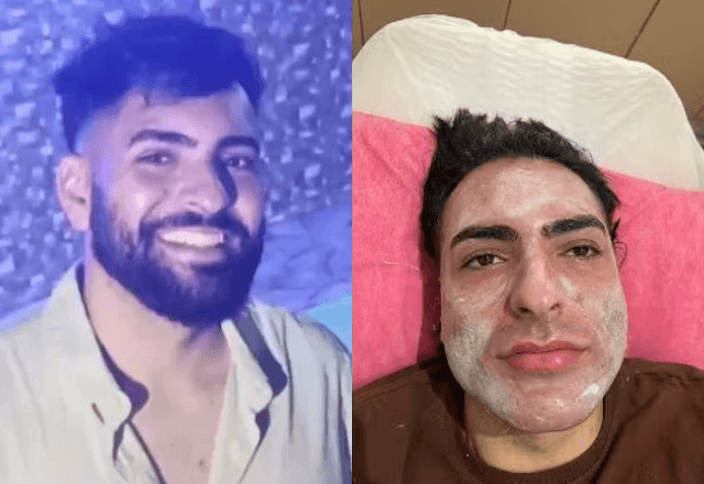 Henrique da Silva Chagas morreu após peeling de fenol em SP | Reprodução/Instagram (Marcelo Camargo)