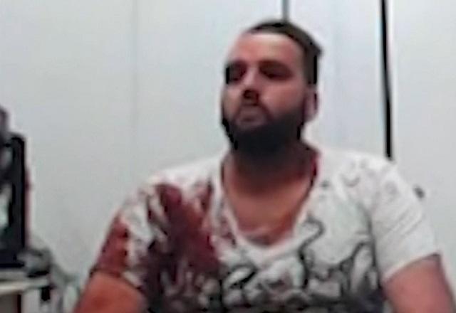 Homem branco com camiseta branca ensanguentada após ser preso