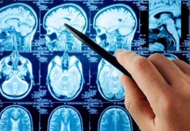 Pesquisa revela neurônios relacionados à compulsão alimentar