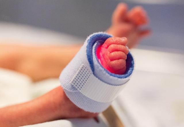 Imagem contém pé de bebê prematuro