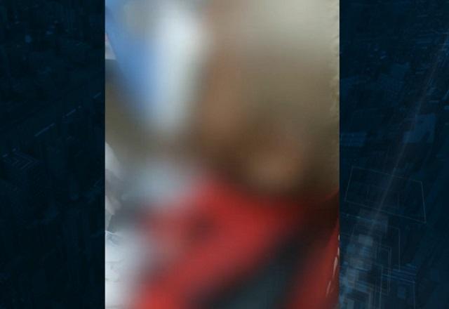 Imagem desfocada de cabeça de jovem negro, com cabelo loiro e curativo de ferimento na região do olho