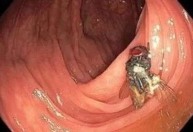 Reprodução/Jornal Americano de Gastroenterologia