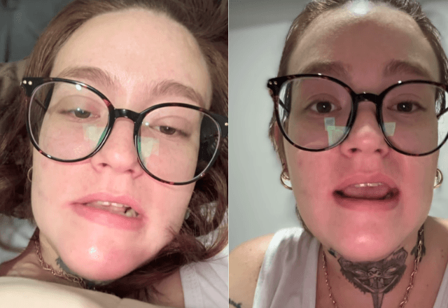 Jovem com a 'pior dor do mundo' diz reconsiderar eutanásia | Reprodução/Instagram