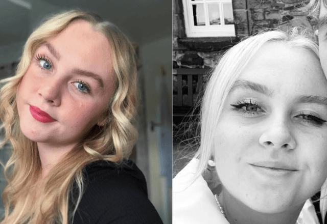 "Tenho que colar meus olhos abertos": jovem de 22 anos é diagnosticada com blefaroespasmo; entenda "Tenho que colar meus olhos abertos": jovem de 22 anos é diagnosticada com blefaroespasmo; entenda