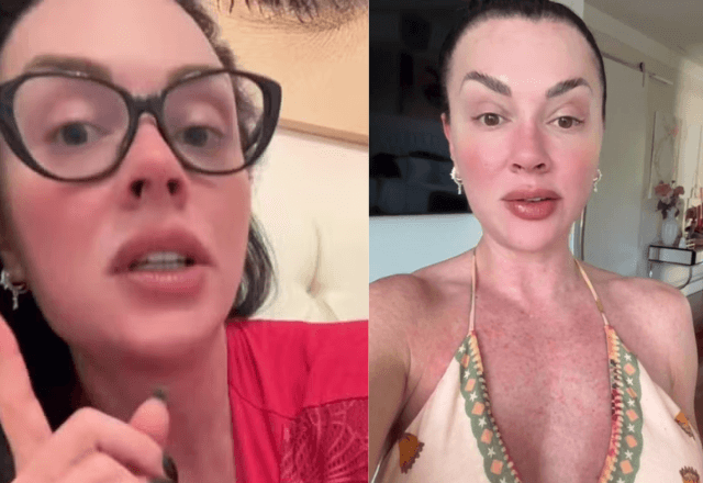 Juju Salimeni relata coceira e manchas vermelhas pelo corpo por dengue | Reprodução/redes sociais