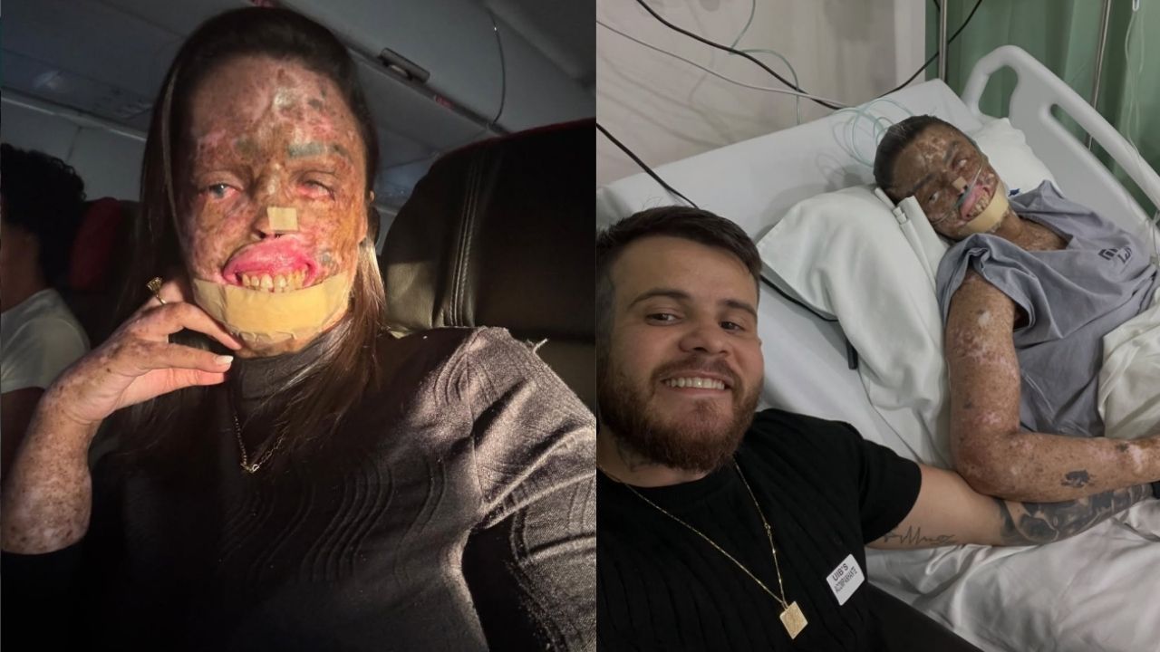 Káh Felipe: influencer compartilhava rotina de tratamento nas redes sociais | Reprodução / Instagram