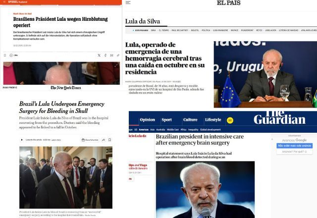Imprensa internacional repercute cirurgia às pressas de Lula