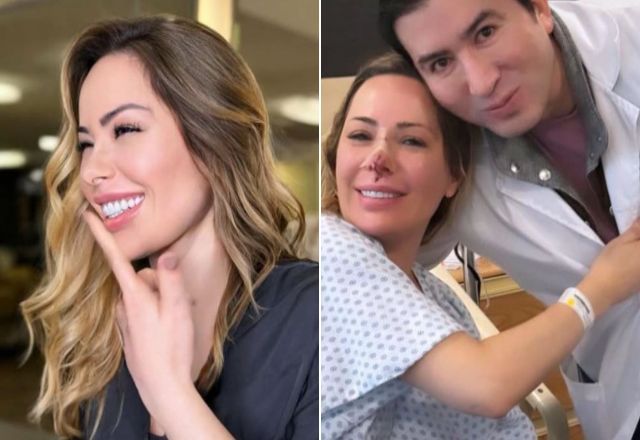 Influenciadora brasileira é atacada por cão no México e passa por cirurgia