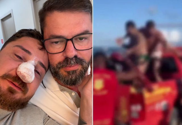 Johnny Andrade Barbosa teve quatro fraturas no rosto após sofrer agressões em Porto de Galinhas | Reprodução/Redes