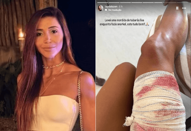 Tayane Cachoeira Dalazen, de 36 anos, teve ferimentos leves após levar uma mordida de tubarão em Fernando de Noronha | Foto: Reprodução/Instagram/@taydalazen