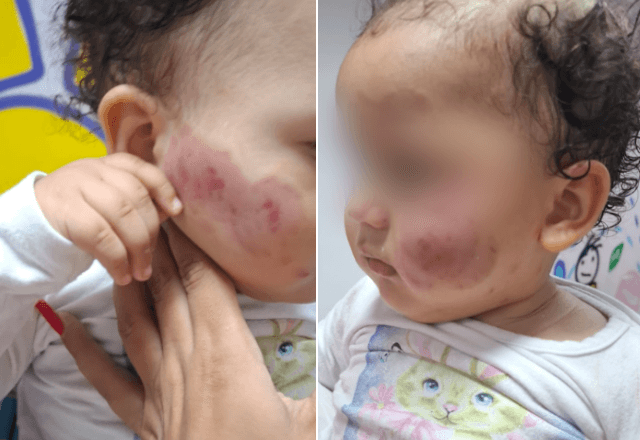 Bebê deixa creche com hematomas em Carapicuíba (SP) | SBT