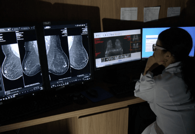 ANS amplia faixa etária para mamografia na rede privada